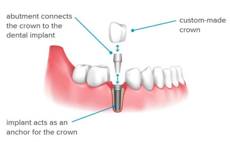 dental